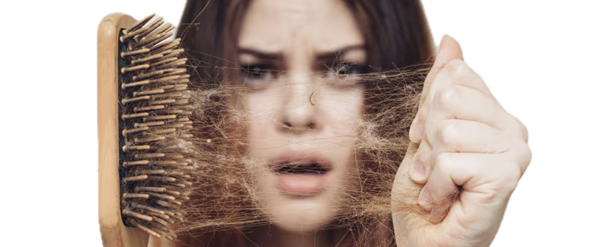 Caduta dei capelli e calvizie femminile